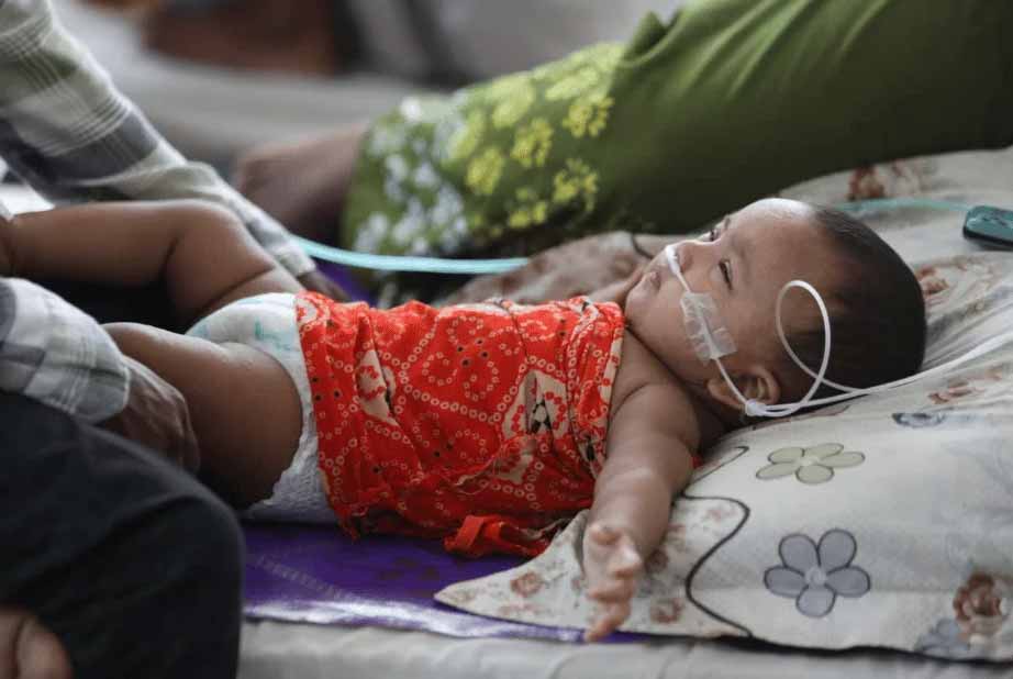 Measles death toll hits 867